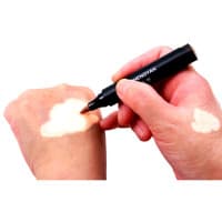 Zanderm Vitiligo Concealer